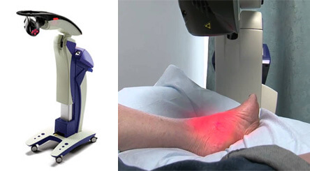 Mls laser therapy Mls laser therapy in the Miami, FL 33125 area
